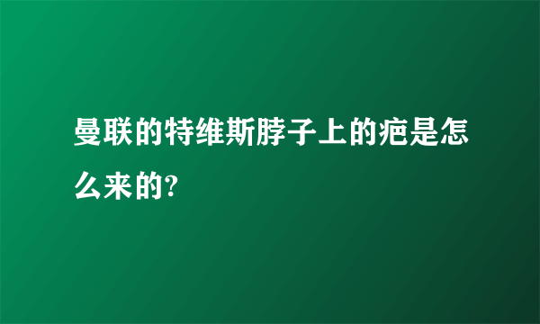 曼联的特维斯脖子上的疤是怎么来的?