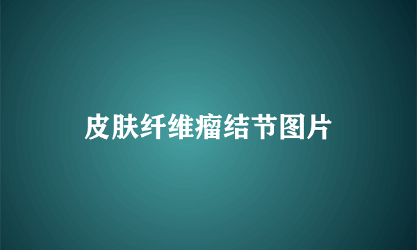 皮肤纤维瘤结节图片