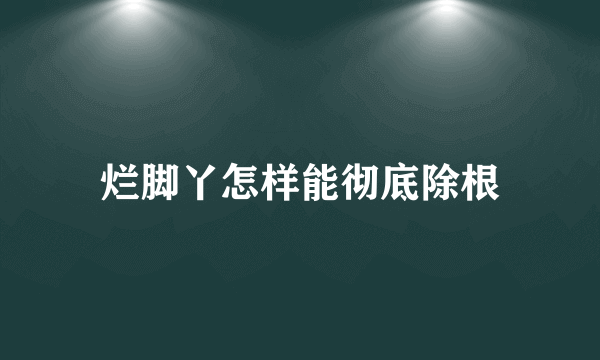 烂脚丫怎样能彻底除根