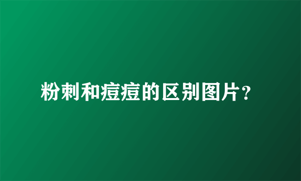 粉刺和痘痘的区别图片？