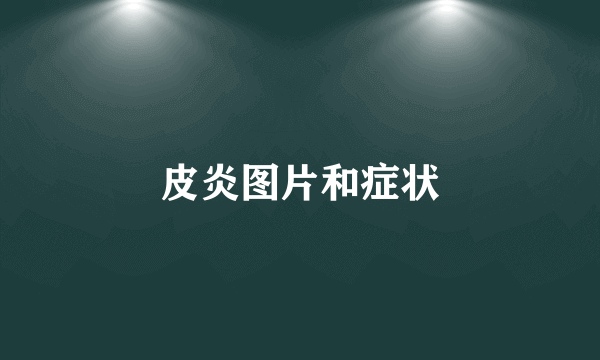皮炎图片和症状