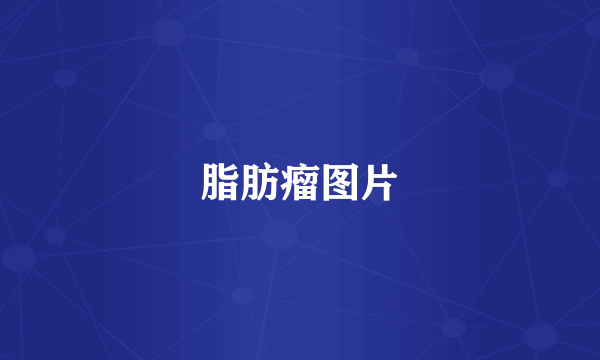 脂肪瘤图片