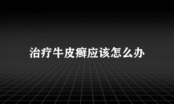治疗牛皮癣应该怎么办