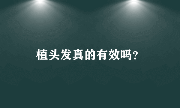 植头发真的有效吗？