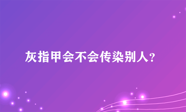 灰指甲会不会传染别人？