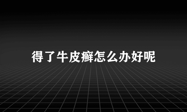 得了牛皮癣怎么办好呢
