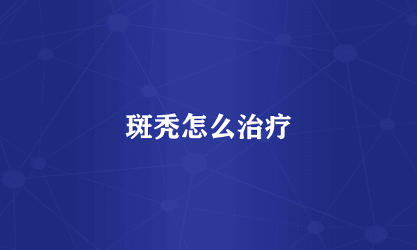 斑秃怎么治疗