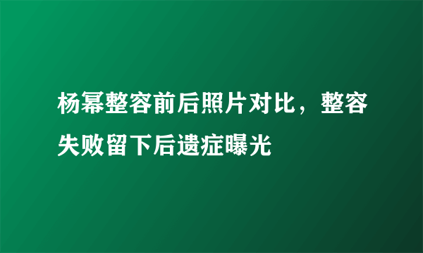 杨幂整容前后照片对比，整容失败留下后遗症曝光