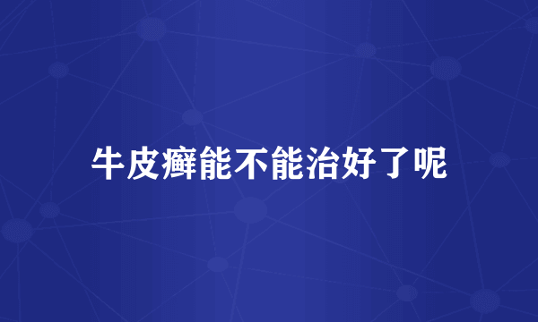 牛皮癣能不能治好了呢