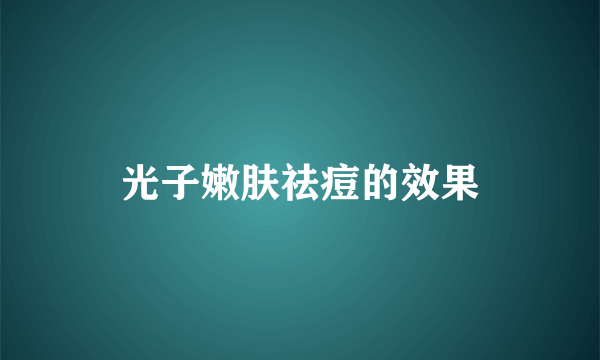 光子嫩肤祛痘的效果