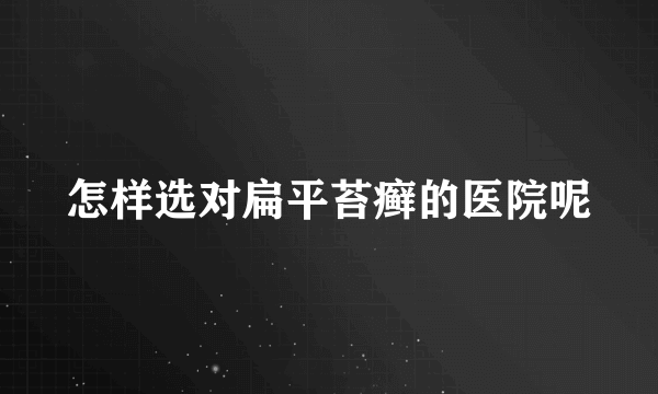 怎样选对扁平苔癣的医院呢