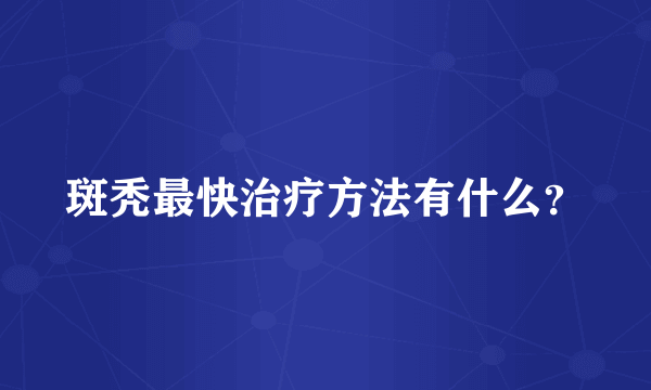 斑秃最快治疗方法有什么？