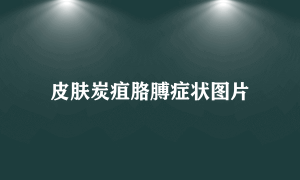皮肤炭疽胳膊症状图片