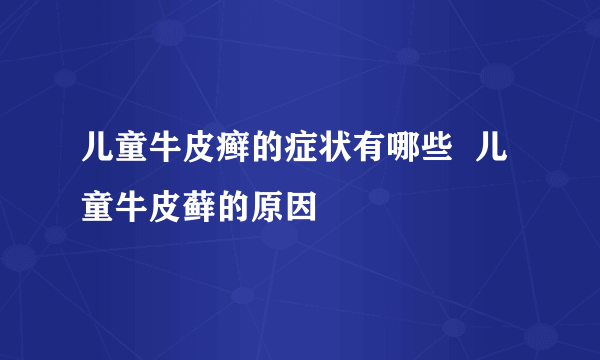 儿童牛皮癣的症状有哪些  儿童牛皮藓的原因