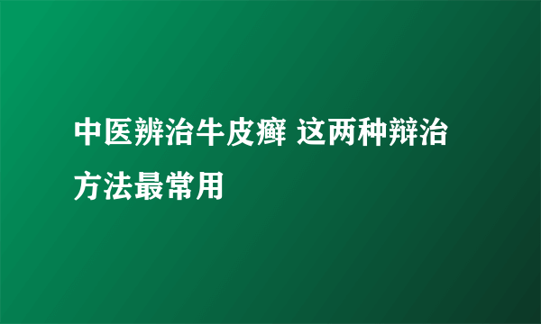 中医辨治牛皮癣 这两种辩治方法最常用