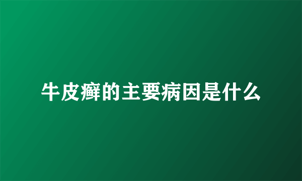 牛皮癣的主要病因是什么