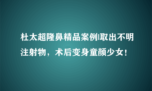 杜太超隆鼻精品案例|取出不明注射物，术后变身童颜少女！