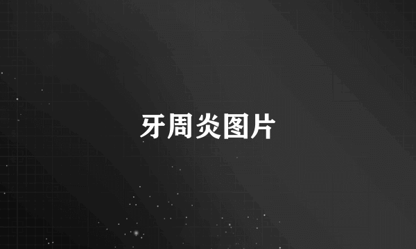 牙周炎图片