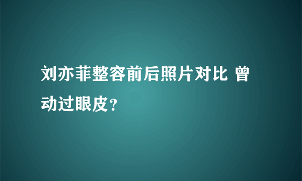 刘亦菲整容前后照片对比 曾动过眼皮？