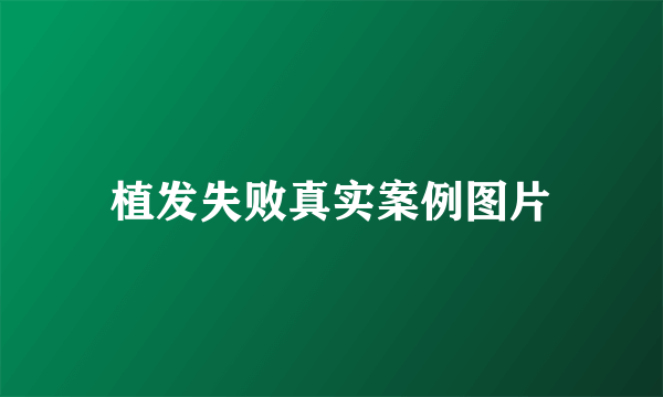 植发失败真实案例图片