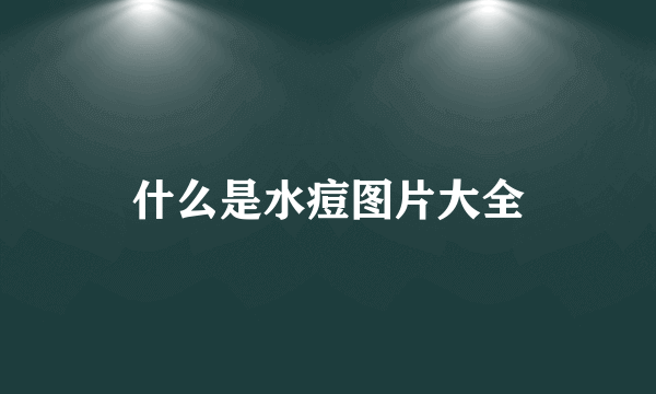 什么是水痘图片大全