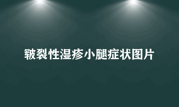 皲裂性湿疹小腿症状图片