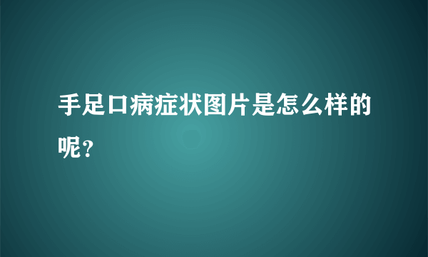 手足口病症状图片是怎么样的呢？