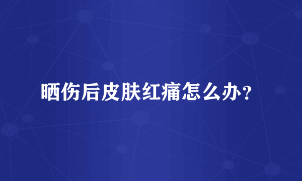 晒伤后皮肤红痛怎么办？
