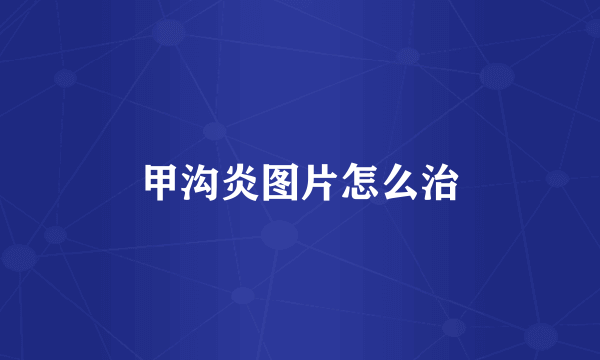 甲沟炎图片怎么治