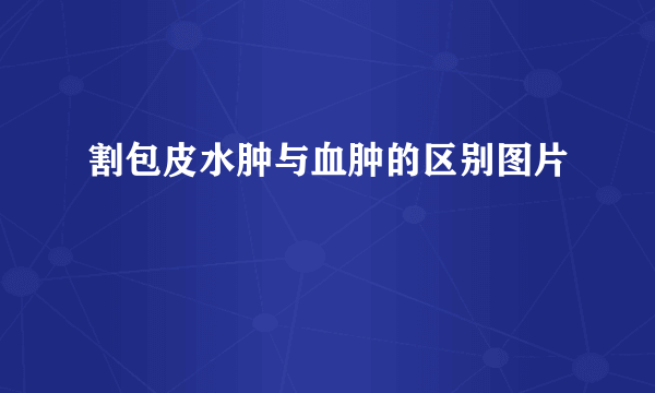 割包皮水肿与血肿的区别图片