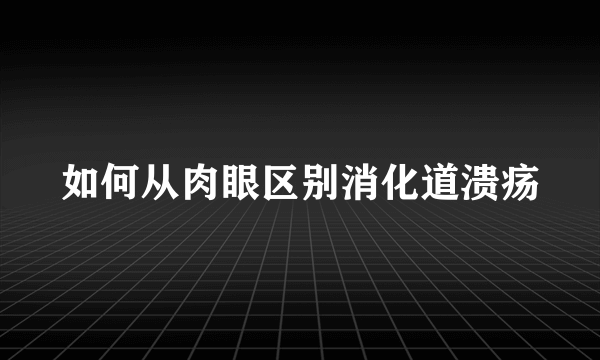 如何从肉眼区别消化道溃疡