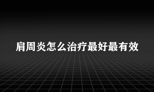 肩周炎怎么治疗最好最有效