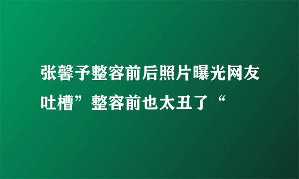 张馨予整容前后照片曝光网友吐槽”整容前也太丑了“