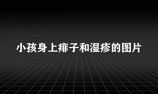 小孩身上痱子和湿疹的图片