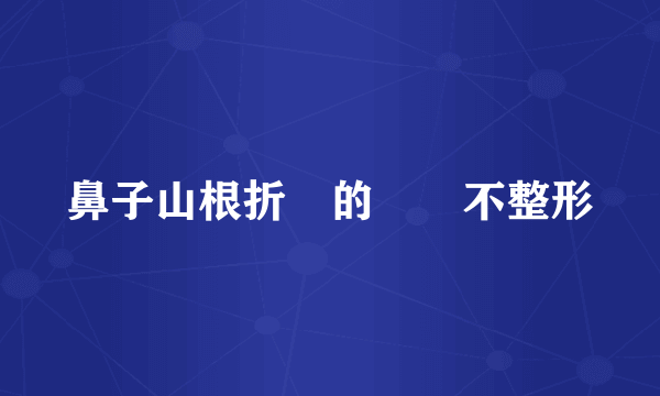 鼻子山根折斷的問題不整形