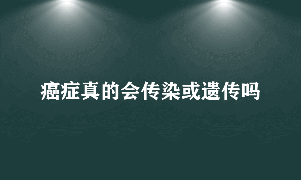 癌症真的会传染或遗传吗
